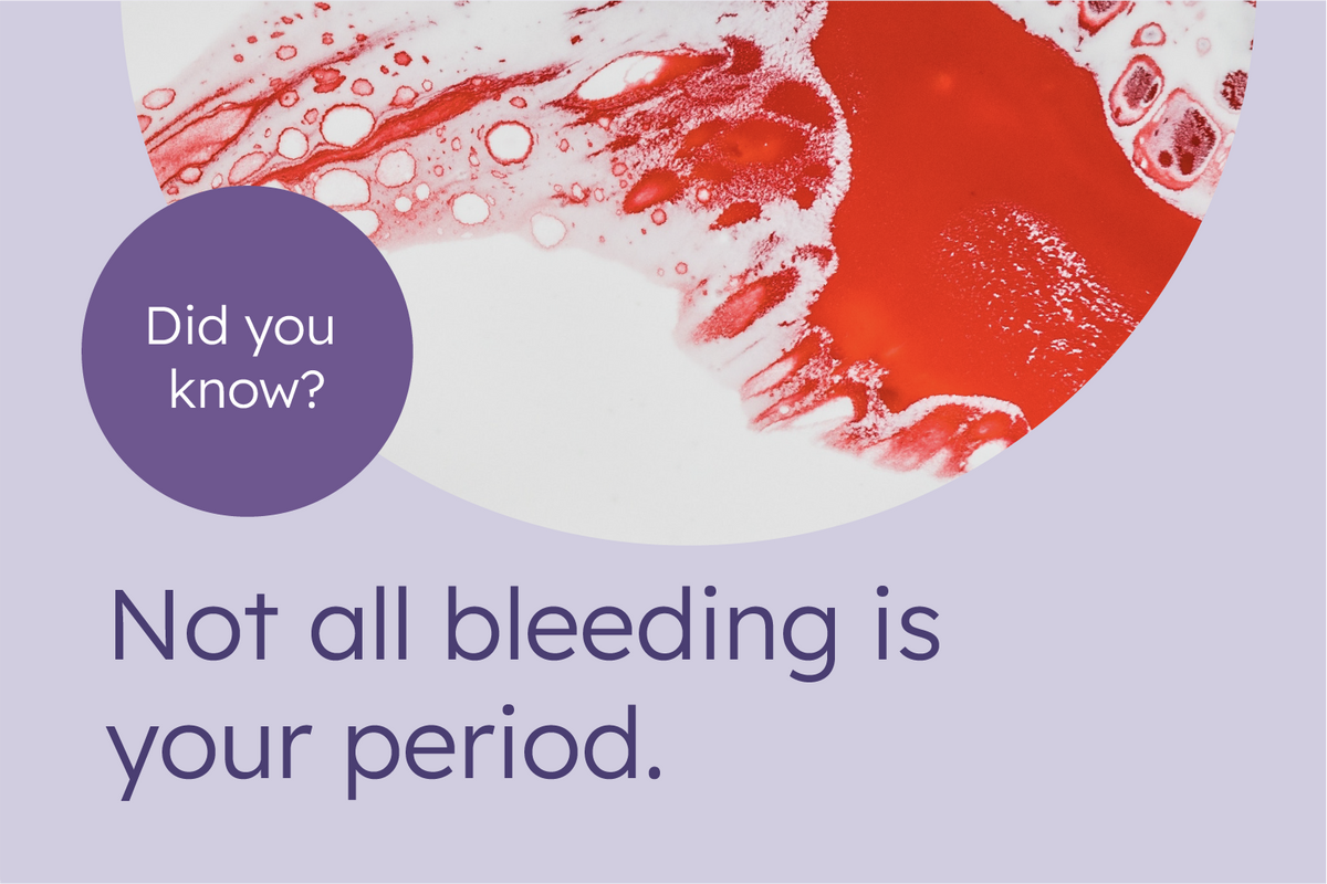 Is it spotting or is it my period?